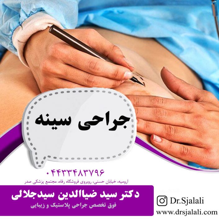 Breast-surgery