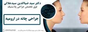 جراحی زیبایی چانه در ارومیه