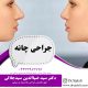 جراحی زیبایی چانه در ارومیه