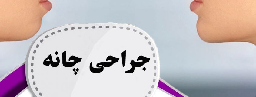 جراحی زیبایی چانه در ارومیه