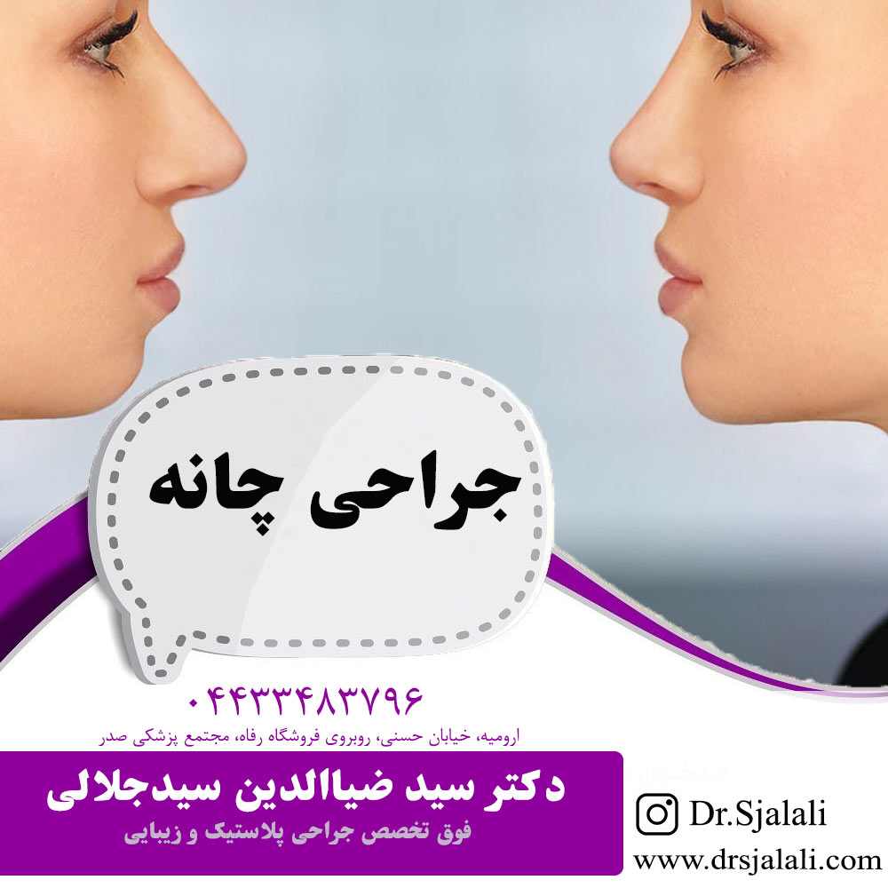 جراحی زیبایی چانه در ارومیه