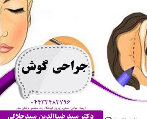 جراحی گوش در ارومیه | اتوپلاستی در ارومیه
