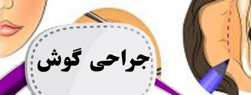 جراحی گوش در ارومیه | اتوپلاستی در ارومیه