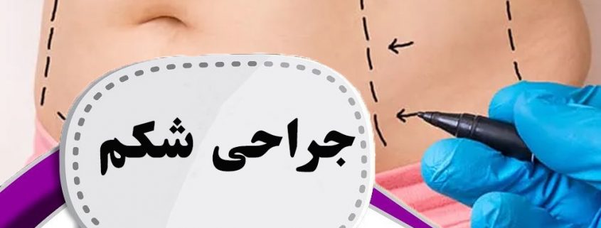 جراحی زیبایی شکم در ارومیه