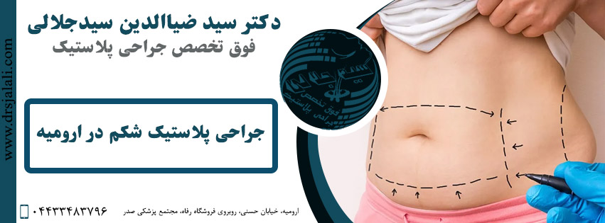 جراحی زیبایی شکم در ارومیه