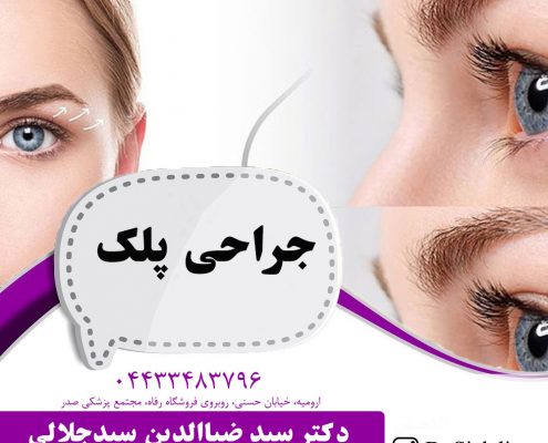 بلفاروپلاستی در ارومیه