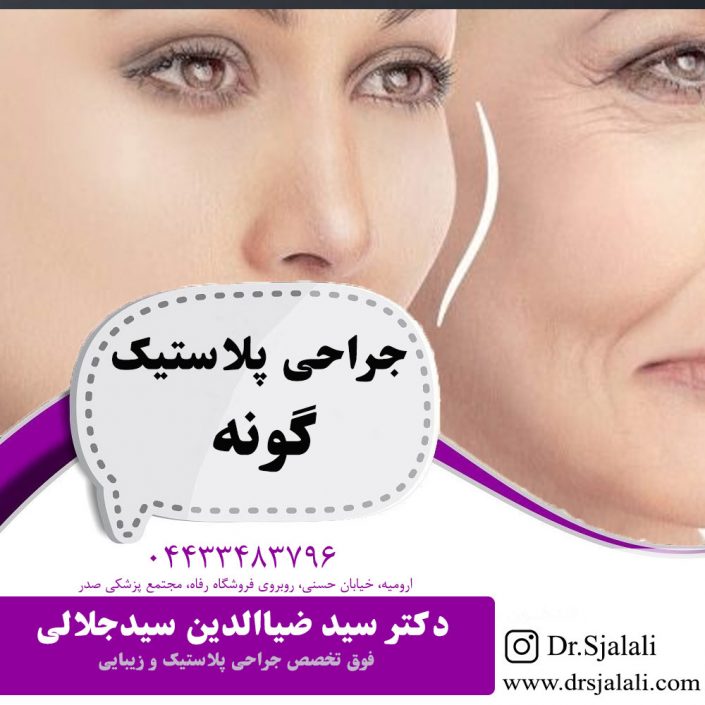 جراحی پلاستیک گونه در ارومیه جراحی پلاستیک گونه در ارومیه