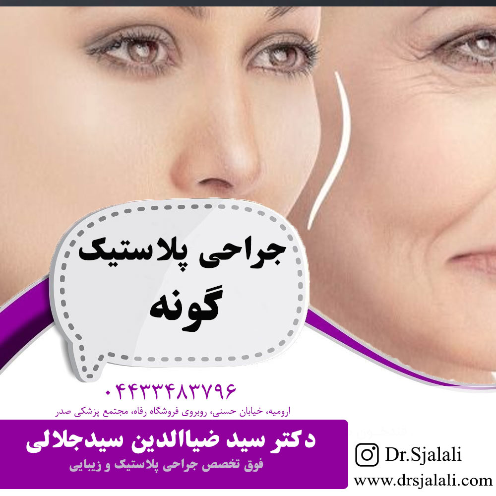 جراحی پلاستیک گونه در ارومیه