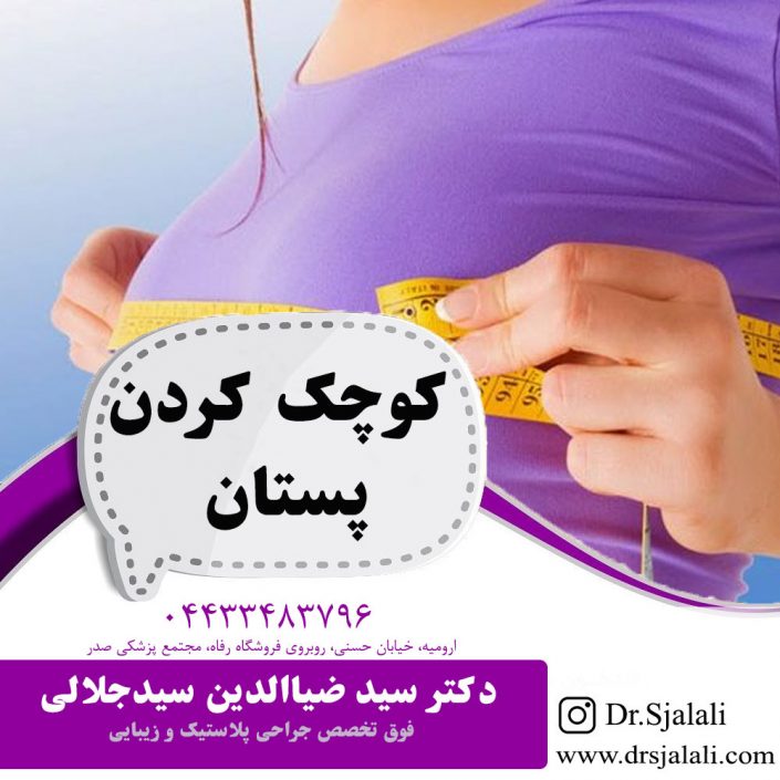 kochek-kardan-pestan کوچک کردن پستان در ارومیه