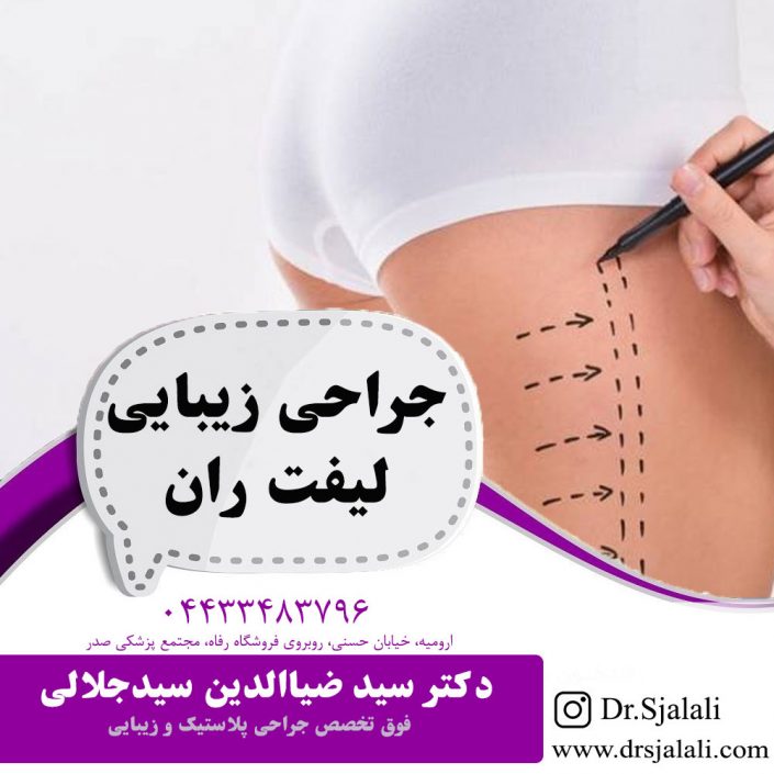 جراحی زیبایی لیفت ران جراحی زیبایی لیفت ران
