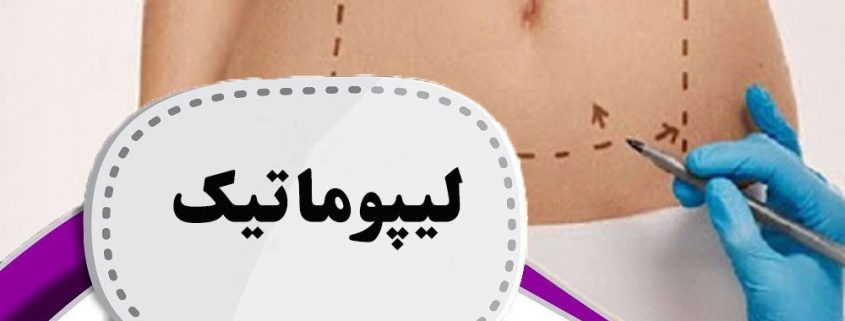 لیپوماتیک در ارومیه