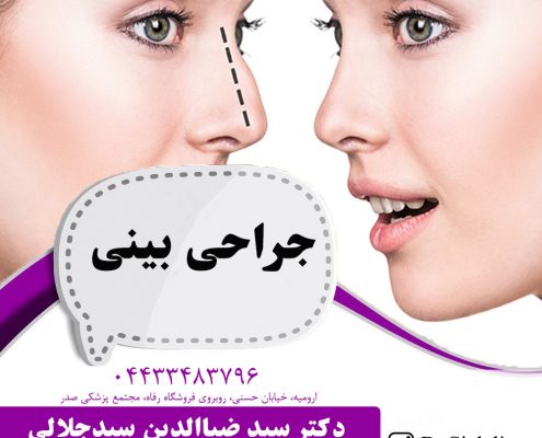 جراحی بینی در ارومیه