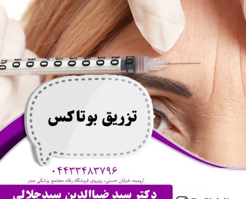 تزریق بوتاکس در ارومیه