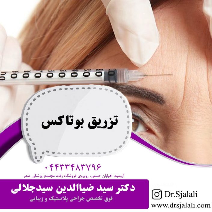تزریق بوتاکس در ارومیه تزریق بوتاکس در ارومیه