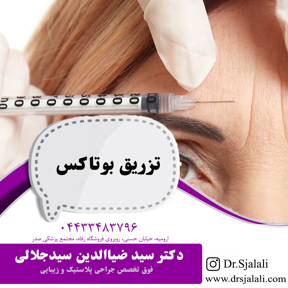 تزریق بوتاکس در ارومیه