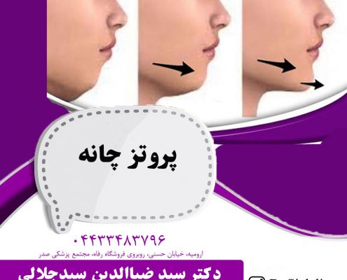 پروتز چانه در ارومیه