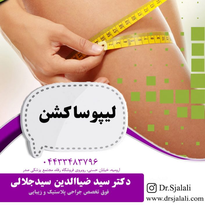 liposuction لیپوساکش در ارومیه