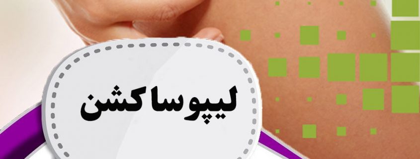 لیپوساکش در ارومیه