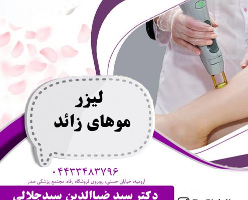 لیزر موهای زائد در ارومیه