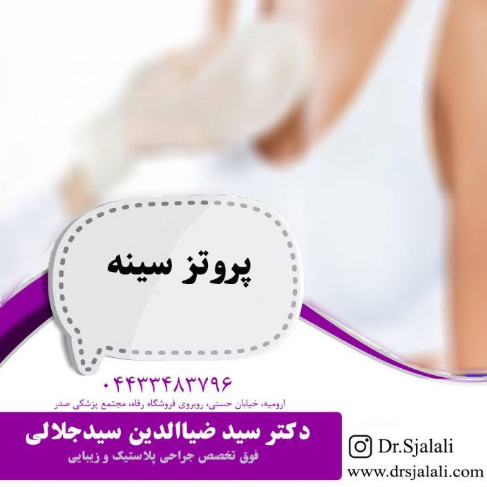 proteze-sineh01