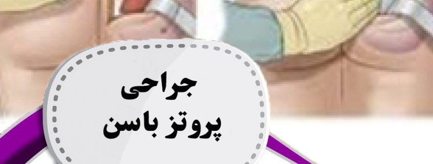 جراحی پروتز باسن در ارومیه