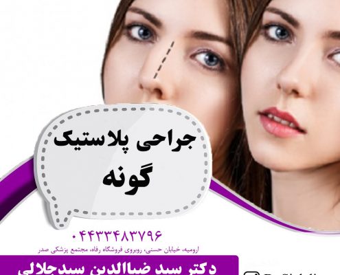 جراحی بینی ثانویه