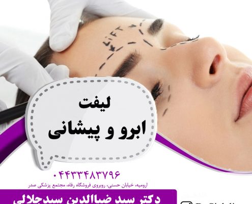 لیفت ابرو وپیشانی در ارومیه