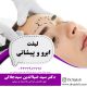 لیفت ابرو وپیشانی در ارومیه