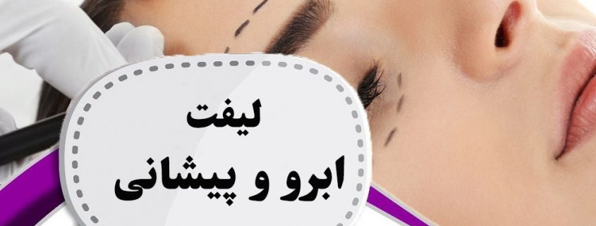 لیفت ابرو وپیشانی در ارومیه