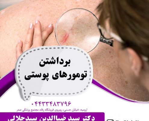برداشتن-تومورهای-پوستی