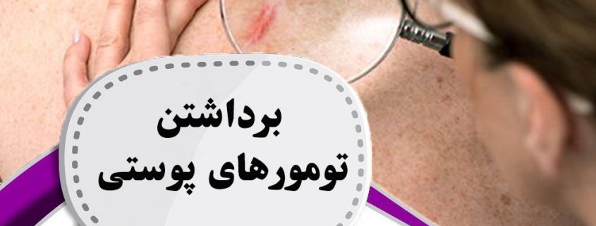 برداشتن-تومورهای-پوستی