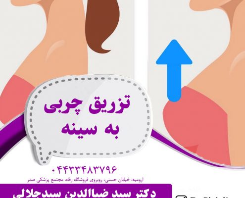 تزریق چربی به سینه