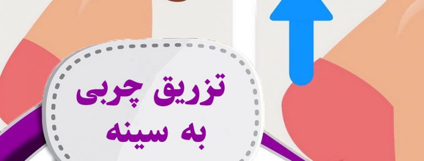 تزریق چربی به سینه