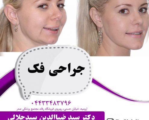 جراحی فک در ارومیه