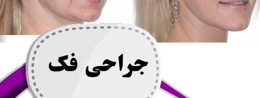 جراحی فک در ارومیه