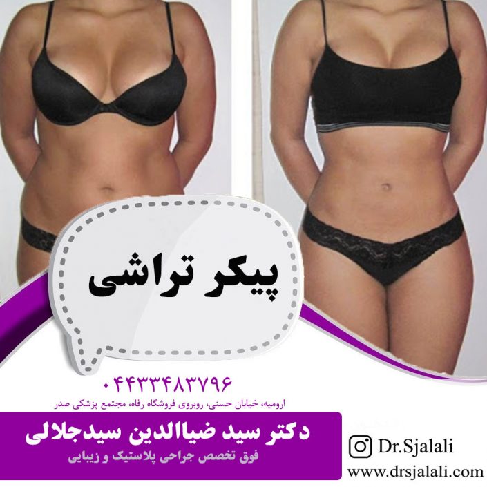 پیکر تراشی در ارومیه پیکر تراشی در ارومیه